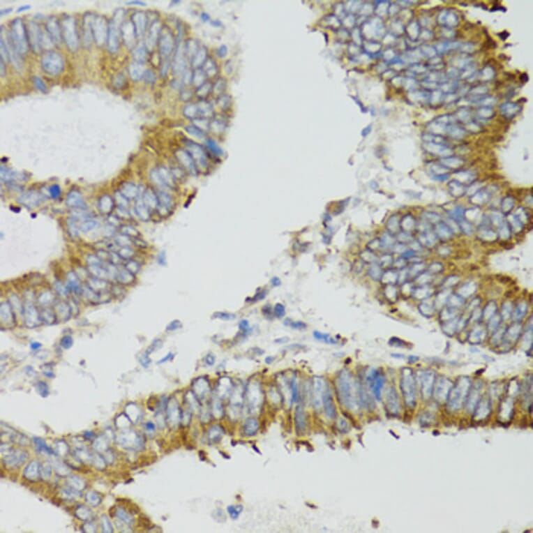Immunohistochemistry - Anti-MT-ND5 Antibody (A17224) - Antibodies.com