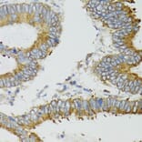 Immunohistochemistry - Anti-MT-ND5 Antibody (A17224) - Antibodies.com