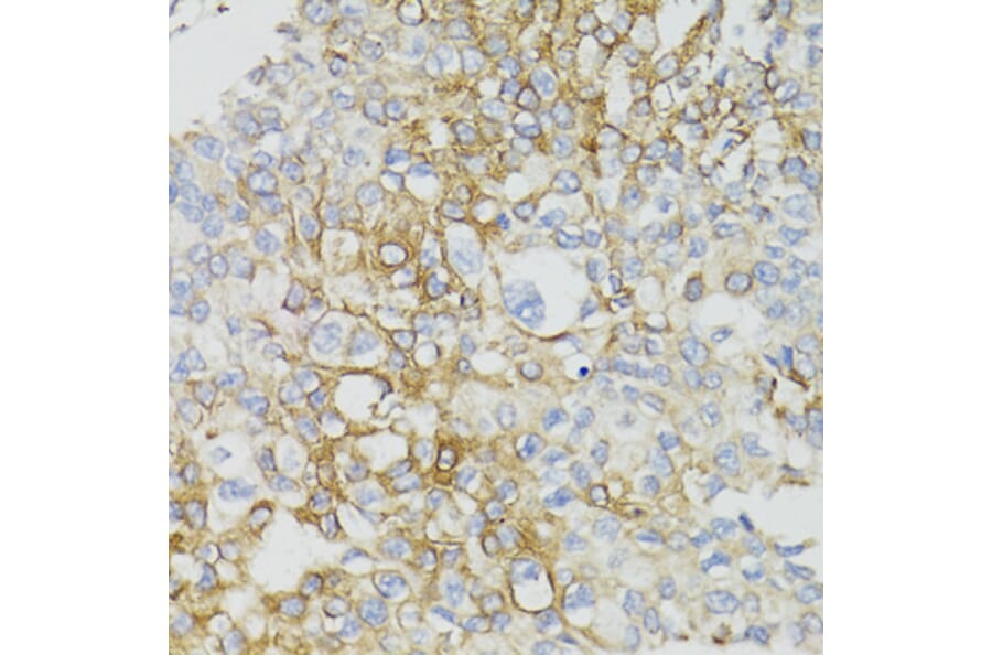 Immunohistochemistry - Anti-MT-ND5 Antibody (A17224) - Antibodies.com