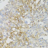 Immunohistochemistry - Anti-MT-ND5 Antibody (A17224) - Antibodies.com