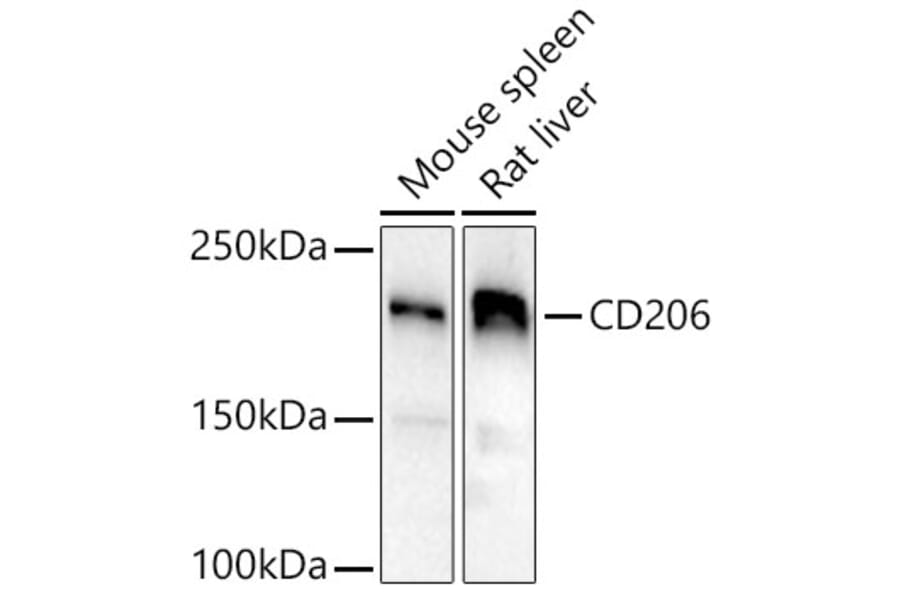 Western Blot - Anti-Mannose Receptor Antibody (A17227) - Antibodies.com