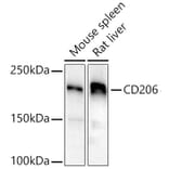 Western Blot - Anti-Mannose Receptor Antibody (A17227) - Antibodies.com