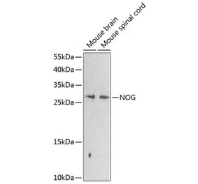 Western Blot - Anti-Noggin Antibody (A17228) - Antibodies.com