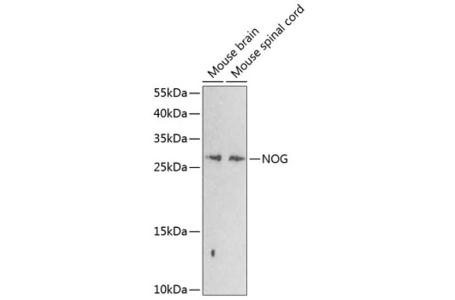 Western Blot - Anti-Noggin Antibody (A17228) - Antibodies.com
