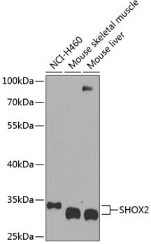 Western blot analysis of extracts of various cell lines, using Anti-SHOX2 Antibody (A8309) at 1:1,000 dilution.
Secondary antibody: Goat Anti-Rabbit IgG (H+L) (HRP) (AS014) at 1:10,000 dilution.
Lysates / proteins: 25µg per lane.
Blocking buffer: 3% non-fat dry milk in TBST.
Detection: ECL Basic Kit (RM00020).
Exposure time: 30s.
