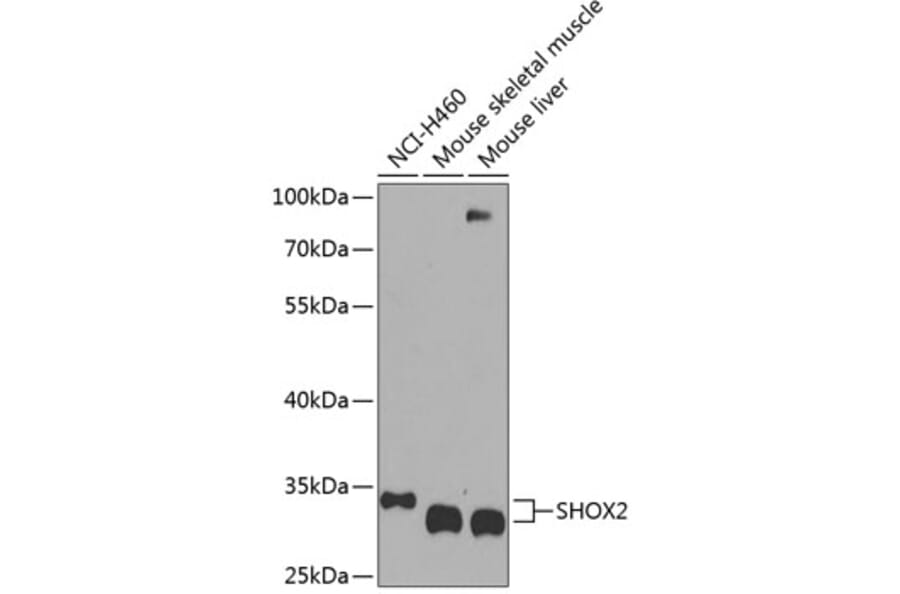 Western Blot - Anti-SHOX2 Antibody (A17229) - Antibodies.com