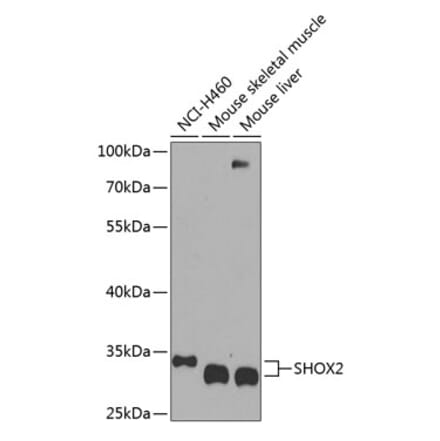 Western Blot - Anti-SHOX2 Antibody (A17229) - Antibodies.com