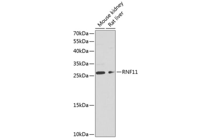 Western Blot - Anti-RNF11 Antibody (A17230) - Antibodies.com