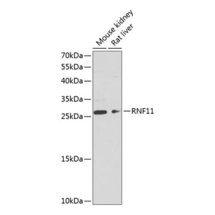 Western Blot - Anti-RNF11 Antibody (A17230) - Antibodies.com