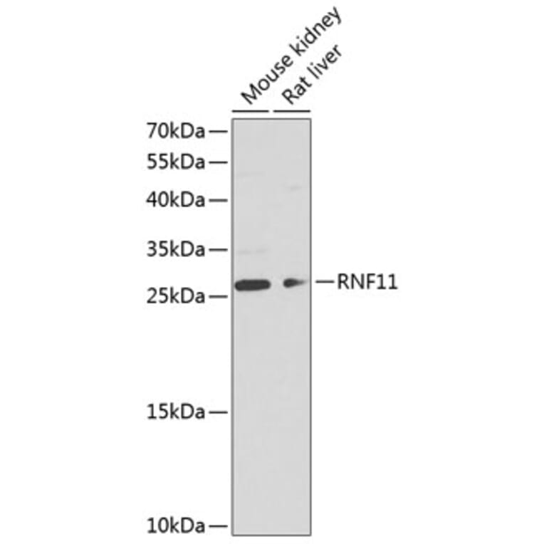 Western Blot - Anti-RNF11 Antibody (A17230) - Antibodies.com