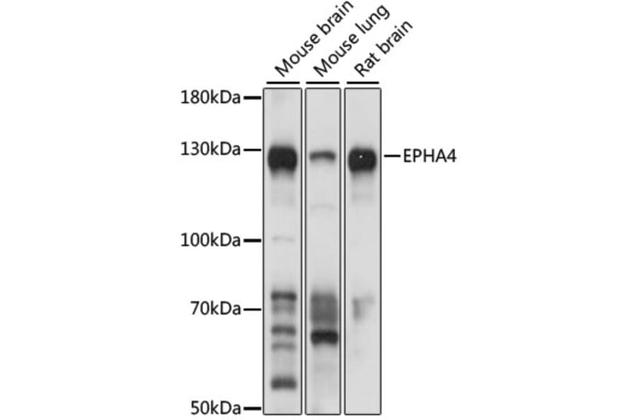 Western Blot - Anti-Eph receptor A4/SEK Antibody (A17232) - Antibodies.com