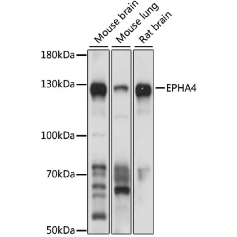 Western Blot - Anti-Eph receptor A4/SEK Antibody (A17232) - Antibodies.com