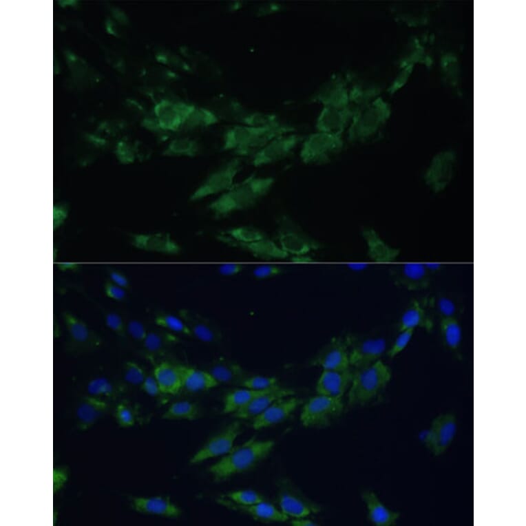 Immunofluorescence - Anti-Eph receptor A4/SEK Antibody (A17232) - Antibodies.com