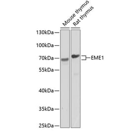 Western Blot - Anti-EME1 Antibody (A17234) - Antibodies.com