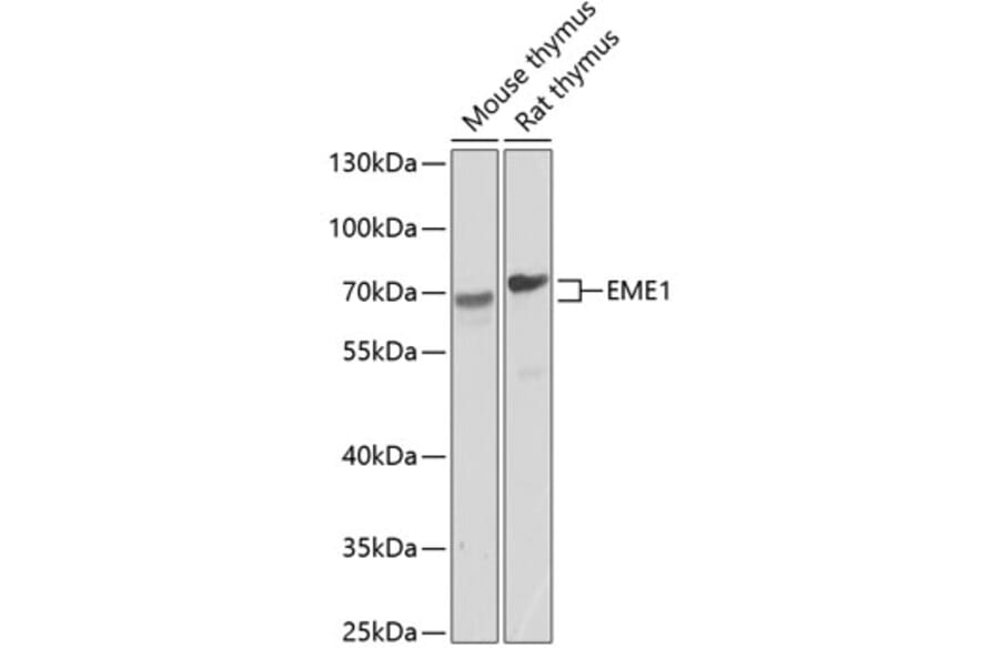 Western Blot - Anti-EME1 Antibody (A17234) - Antibodies.com