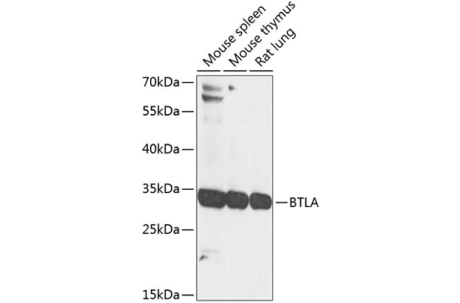 Western Blot - Anti-CD272/BTLA Antibody (A17235) - Antibodies.com