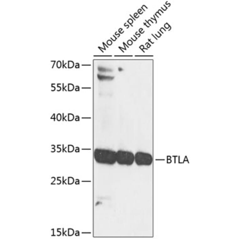 Western Blot - Anti-CD272/BTLA Antibody (A17235) - Antibodies.com