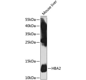 Western Blot - Anti-Hemoglobin subunit alpha Antibody (A17236) - Antibodies.com