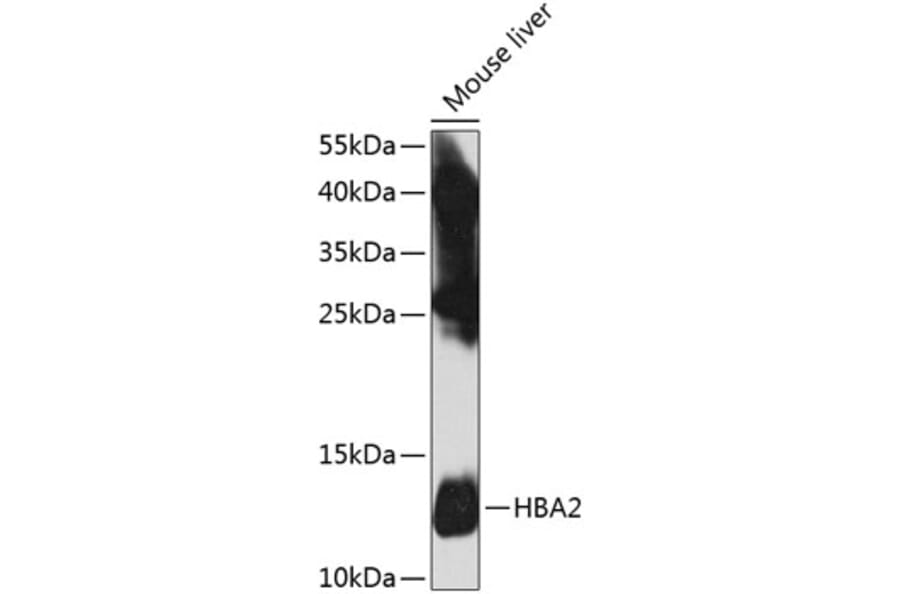 Western Blot - Anti-Hemoglobin subunit alpha Antibody (A17236) - Antibodies.com
