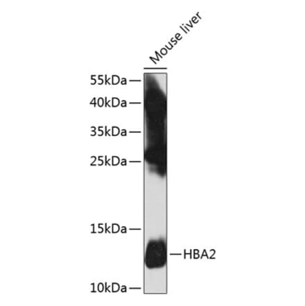 Western Blot - Anti-Hemoglobin subunit alpha Antibody (A17236) - Antibodies.com