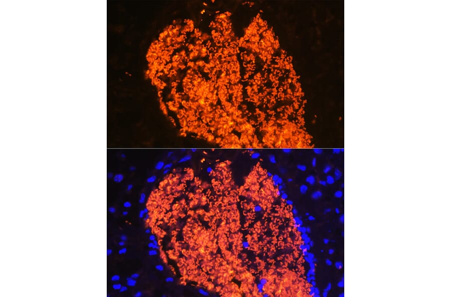Immunofluorescence - Anti-Hemoglobin subunit alpha Antibody (A17236) - Antibodies.com