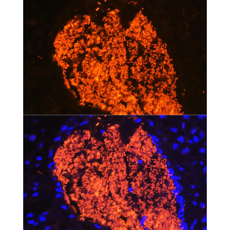 Immunofluorescence - Anti-Hemoglobin subunit alpha Antibody (A17236) - Antibodies.com