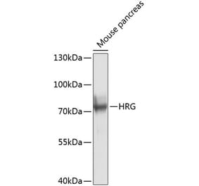 Western Blot - Anti-HRG Antibody (A17237) - Antibodies.com
