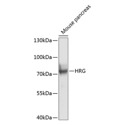 Western Blot - Anti-HRG Antibody (A17237) - Antibodies.com