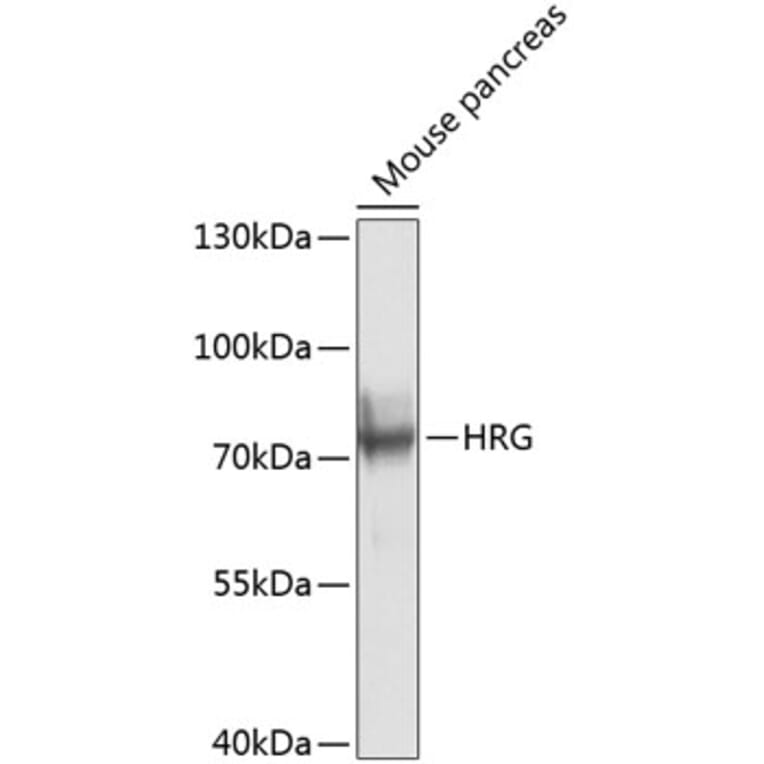 Western Blot - Anti-HRG Antibody (A17237) - Antibodies.com