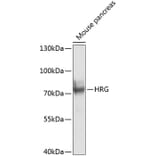 Western Blot - Anti-HRG Antibody (A17237) - Antibodies.com