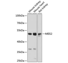 Western Blot - Anti-MEIS2 Antibody (A17239) - Antibodies.com