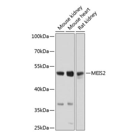 Western Blot - Anti-MEIS2 Antibody (A17239) - Antibodies.com