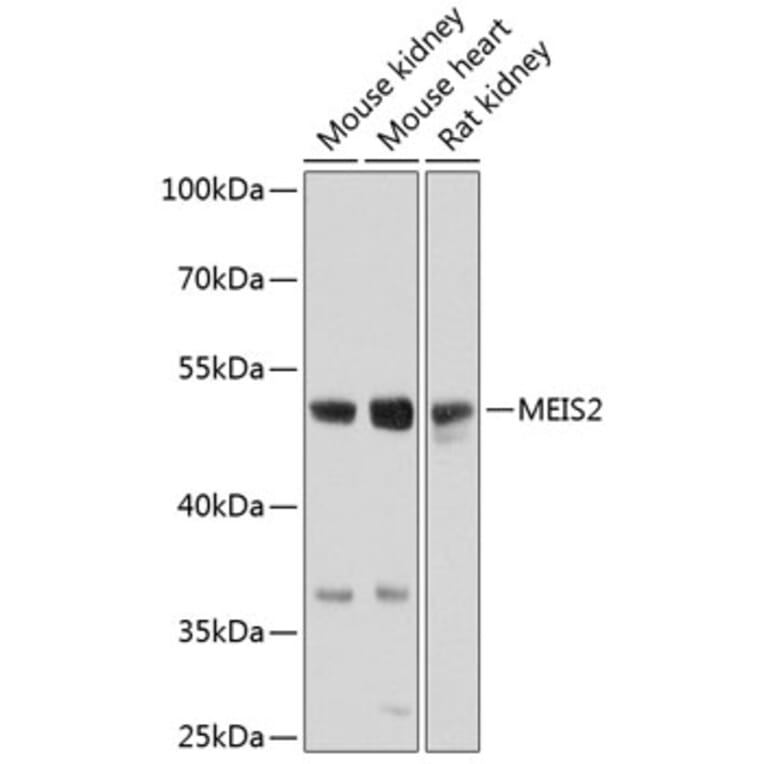 Western Blot - Anti-MEIS2 Antibody (A17239) - Antibodies.com
