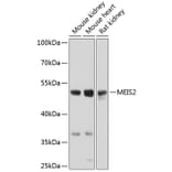 Western Blot - Anti-MEIS2 Antibody (A17239) - Antibodies.com