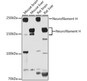 Western Blot - Anti-Neurofilament heavy polypeptide Antibody (A17240) - Antibodies.com
