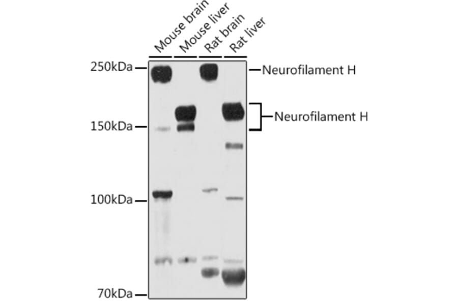 Western Blot - Anti-Neurofilament heavy polypeptide Antibody (A17240) - Antibodies.com