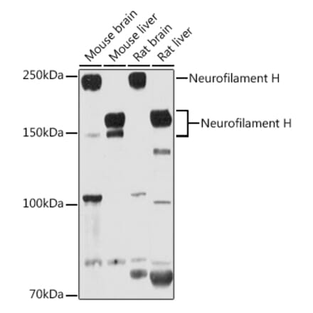 Western Blot - Anti-Neurofilament heavy polypeptide Antibody (A17240) - Antibodies.com
