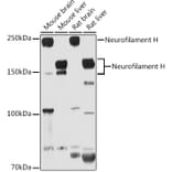 Western Blot - Anti-Neurofilament heavy polypeptide Antibody (A17240) - Antibodies.com