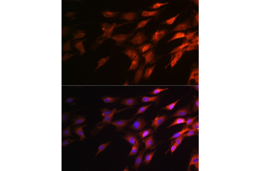 Immunofluorescence - Anti-Neurofilament heavy polypeptide Antibody (A17240) - Antibodies.com
