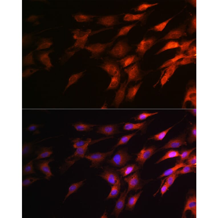 Immunofluorescence - Anti-Neurofilament heavy polypeptide Antibody (A17240) - Antibodies.com