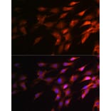 Immunofluorescence - Anti-Neurofilament heavy polypeptide Antibody (A17240) - Antibodies.com