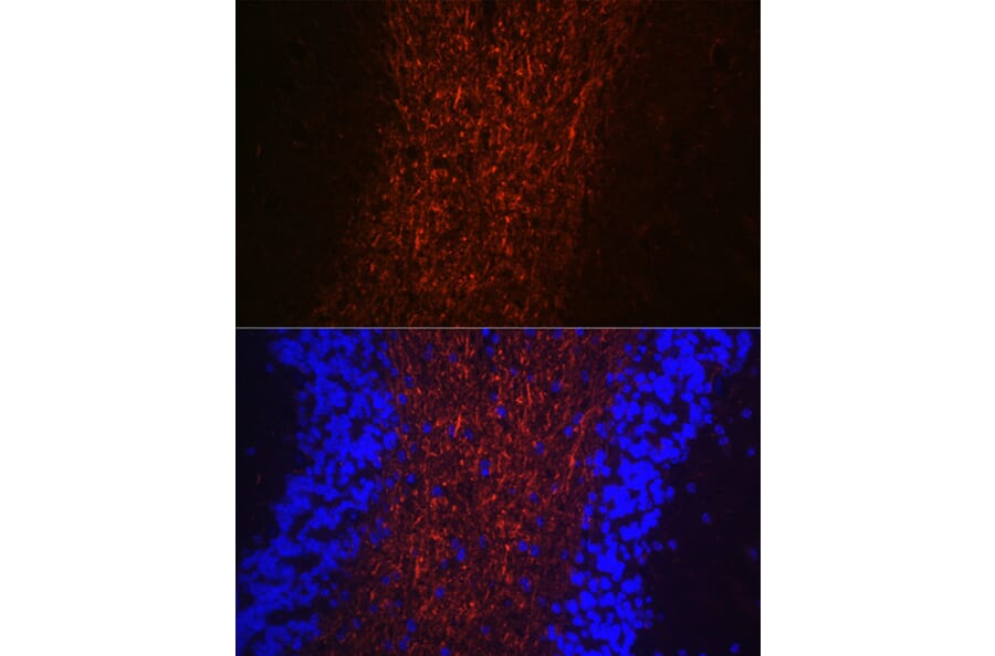 Immunofluorescence - Anti-Neurofilament heavy polypeptide Antibody (A17240) - Antibodies.com