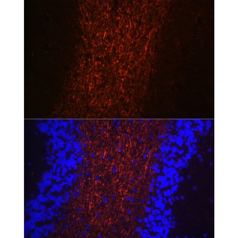 Immunofluorescence - Anti-Neurofilament heavy polypeptide Antibody (A17240) - Antibodies.com