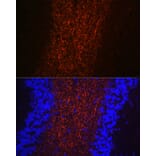 Immunofluorescence - Anti-Neurofilament heavy polypeptide Antibody (A17240) - Antibodies.com