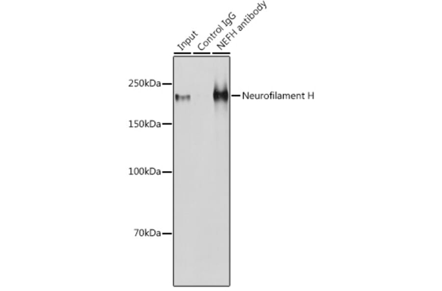 Western Blot - Anti-Neurofilament heavy polypeptide Antibody (A17240) - Antibodies.com