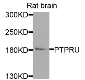 Western Blot - Anti-PTPRU Antibody (A8475) - Antibodies.com