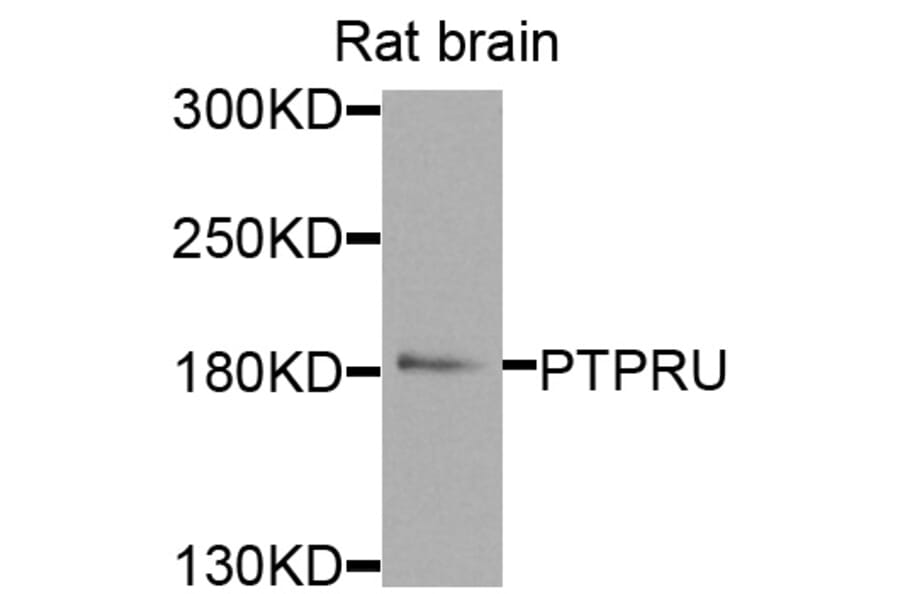 Western Blot - Anti-PTPRU Antibody (A8475) - Antibodies.com