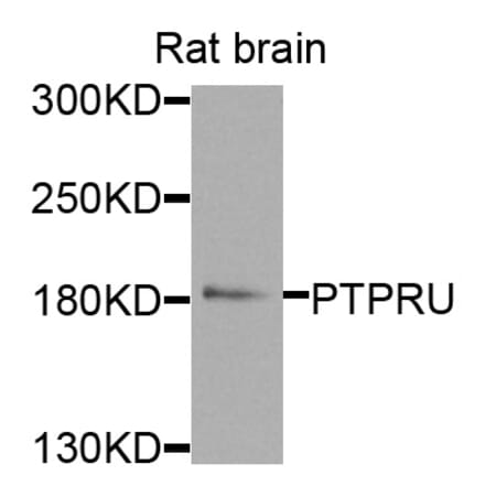 Western Blot - Anti-PTPRU Antibody (A8475) - Antibodies.com