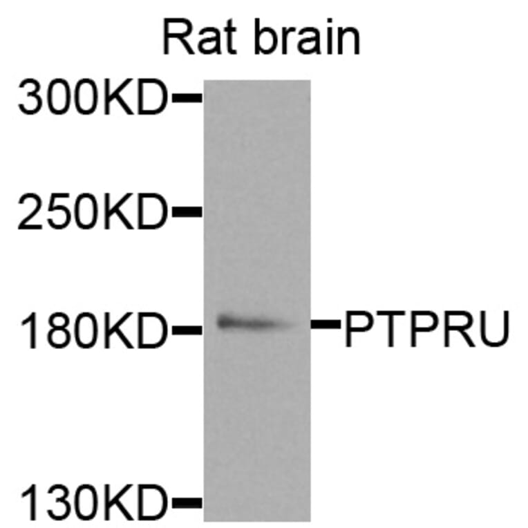 Western Blot - Anti-PTPRU Antibody (A8475) - Antibodies.com