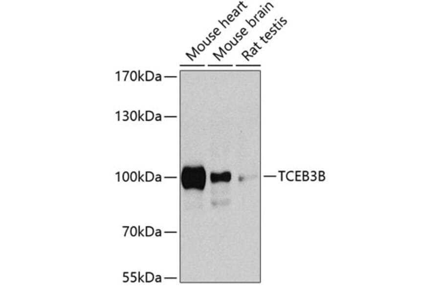 Western Blot - Anti-TCEB3B Antibody (A17242) - Antibodies.com